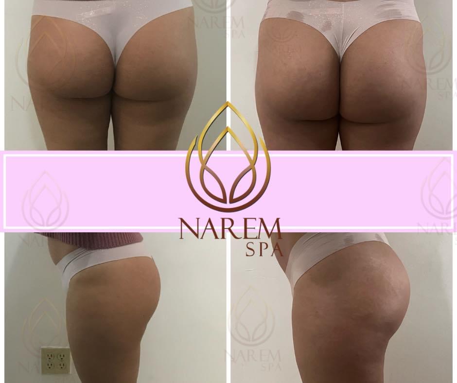 Narem Spa | Blvd. Fundadores 450, 21478 Tecate, B.C., Mexico | Phone: 665 150 8904