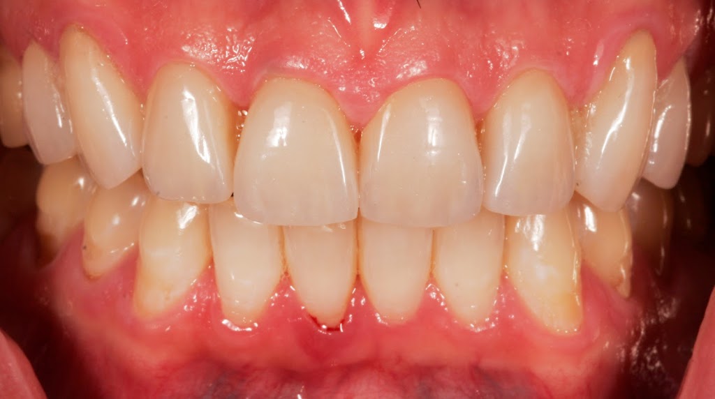 Ianto Dental Studio - health  | Photo 5 of 6 | Address: 7500 NW 5th St #101, Plantation, FL 33317, USA | Phone: (954) 792-3444
