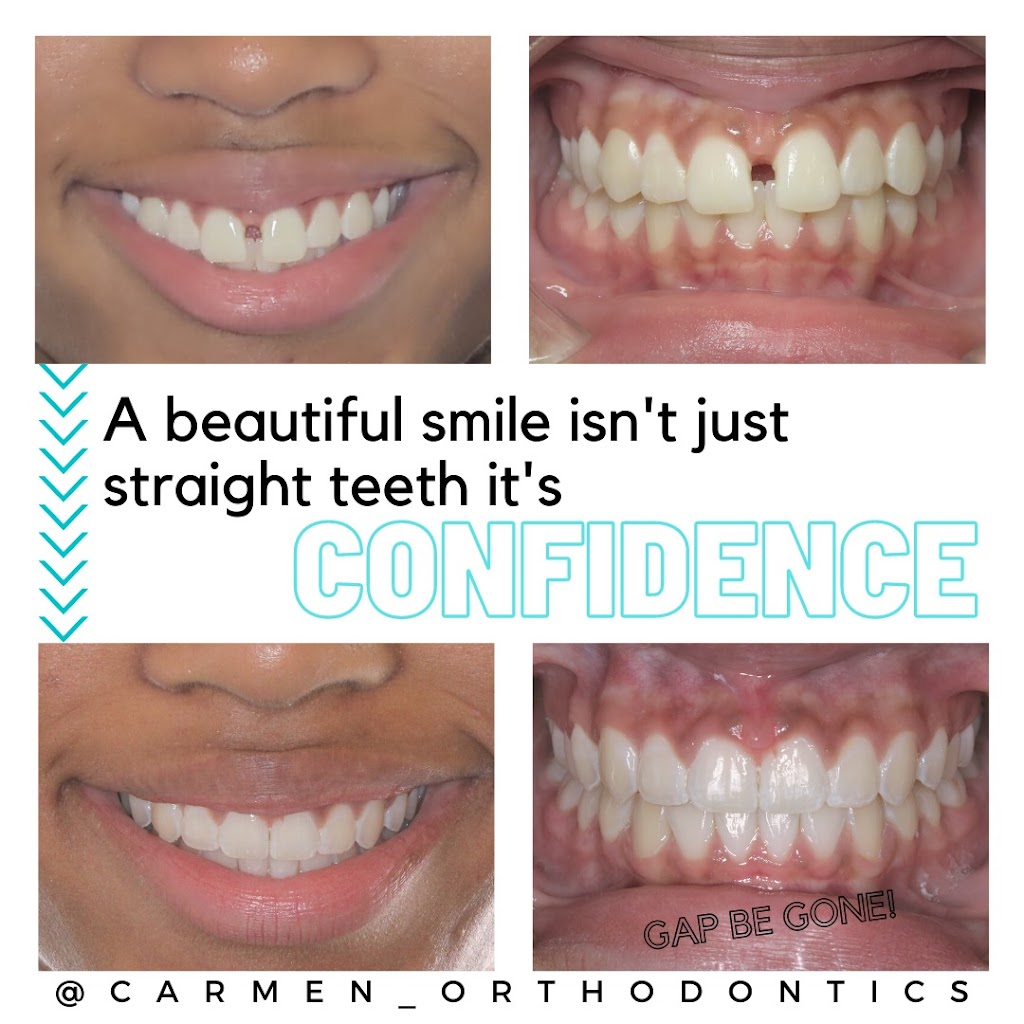 Carmen Orthodontics | 177 W Columbus St, Pickerington, OH 43147, USA | Phone: (614) 833-5004