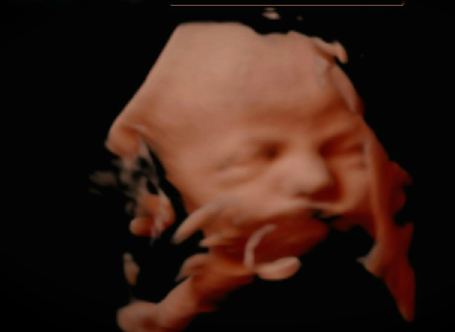 Keepsake Prenatal Imagaing 3D/4D HD Ultrasound Studio | 5656 US-29, Blairs, VA 24527, USA | Phone: (434) 429-1069