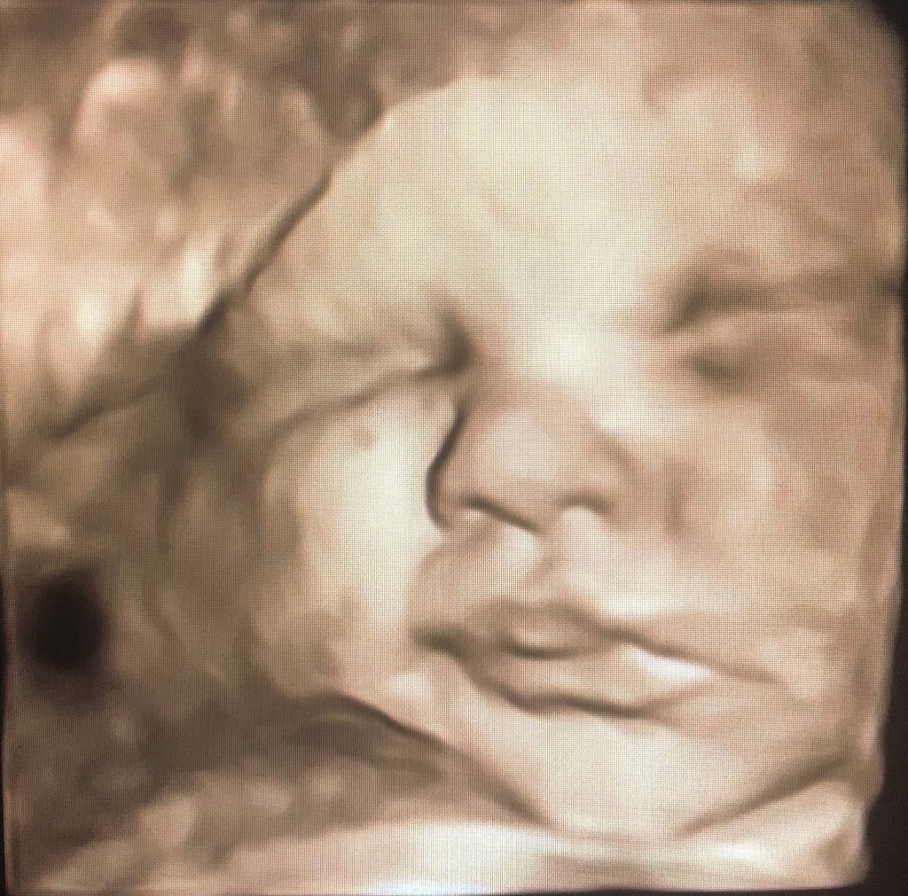 For Kicks & Giggles 3D/4D HDlive Ultrasound Studio & Boutique | 12630 Curley St STE 103, San Antonio, FL 33576, USA | Phone: (352) 588-0912