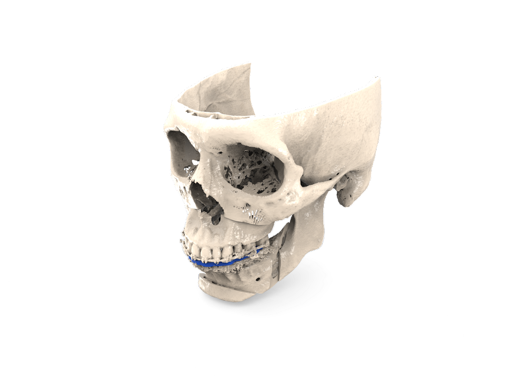 TECHFIT Digital Surgery | 1511 Aviation Center Pkwy Suite 220H, Daytona Beach, FL 32114, USA | Phone: (386) 872-0872