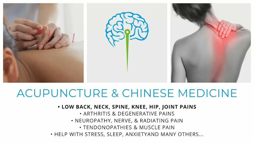 Neuro Point Acupuncture | 5670 54th Ave N Unit D, Kenneth City, FL 33709, USA | Phone: (727) 469-3209