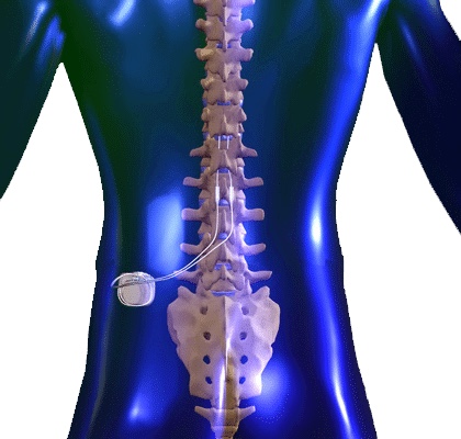 NeuRepair Brain and Spine Wellness Centers | 8140 Picton Way Suite 102, Trinity, FL 34655, USA | Phone: (727) 494-7573