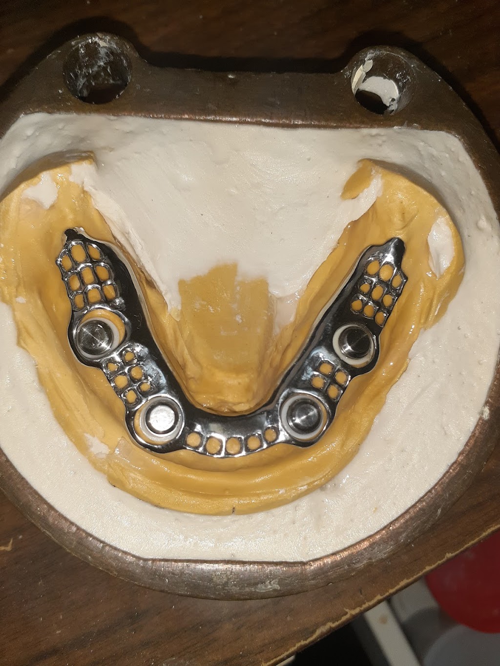 R&B Dental Lab | 21374 Ramona Ave, Apple Valley, CA 92307, USA | Phone: (760) 261-2425