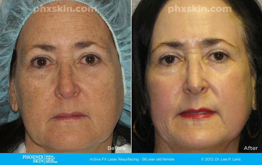 Phoenix Skin Medical Surgical Group | 7312 E Deer Valley Rd #105, Scottsdale, AZ 85255, USA | Phone: (480) 473-9111