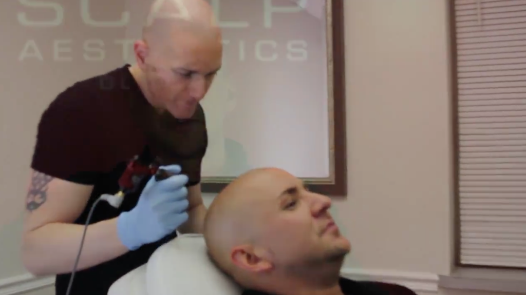 Scalp Aesthetics Buffalo | 338 Harris Hill Rd Ste 109, Williamsville, NY 14221, USA | Phone: (716) 970-4700