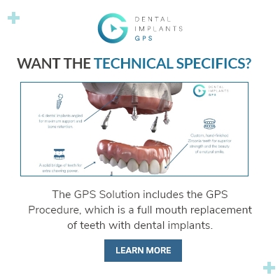 Dental Implants GPS | 1000 Lakes Dr # 150, West Covina, CA 91790, United States | Phone: (626) 546-0580