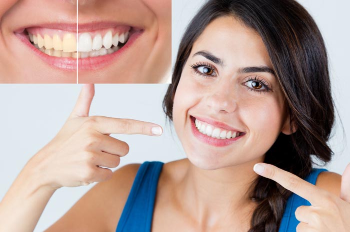 Smiley Dental Lowell | 1141 Bridge St, Lowell, MA 01850, USA | Phone: (978) 999-9000