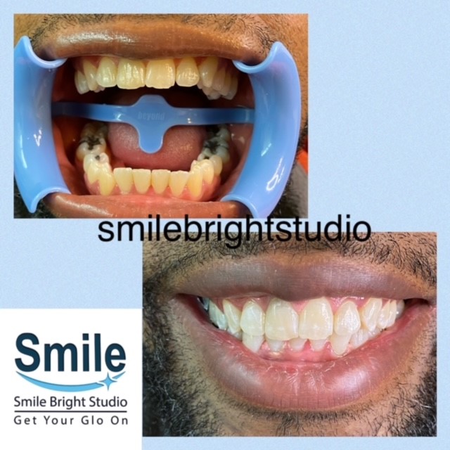 Smile Bright Studio | 1256 W Chandler Blvd #28, Chandler, AZ 85224, USA | Phone: (480) 262-2324