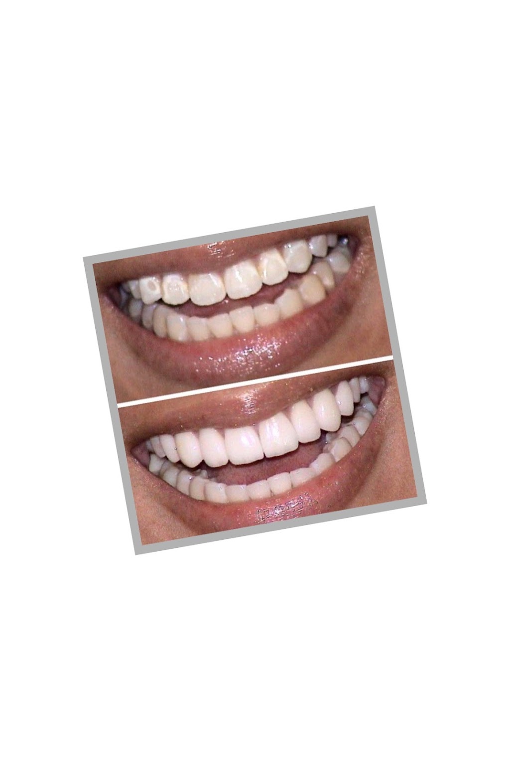 SmileUp Dentistry | 3000 FM407 #300, Bartonville, TX 76226, USA | Phone: (940) 461-7696