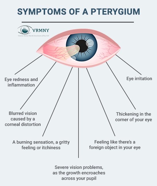 Vitreous Retina Macula Consultants of New York | 950 3rd Ave 3rd floor, New York, NY 10022, United States | Phone: (212) 861-9797
