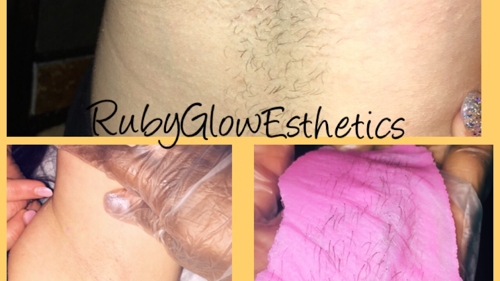 Ruby Glow Esthetics | 1621 Banning Beach Rd, Tavares, FL 32778, USA | Phone: (352) 235-9604