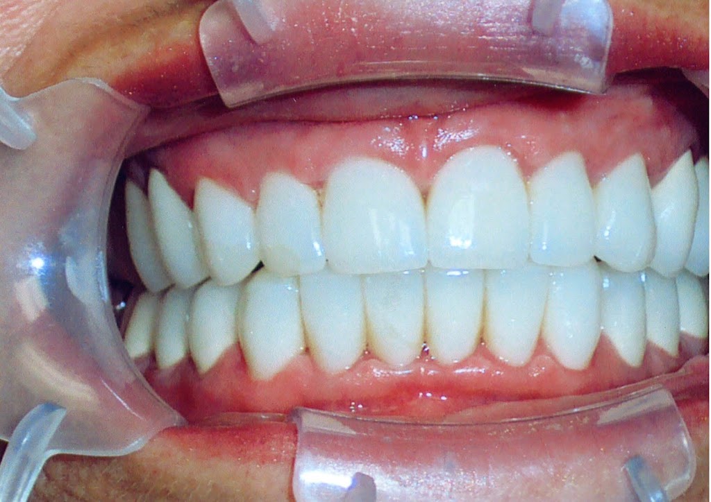 Hopkins Aesthetic & Reconstructive Dentistry | 1952 Bayshore Blvd, Dunedin, FL 34698, USA | Phone: (727) 733-1175