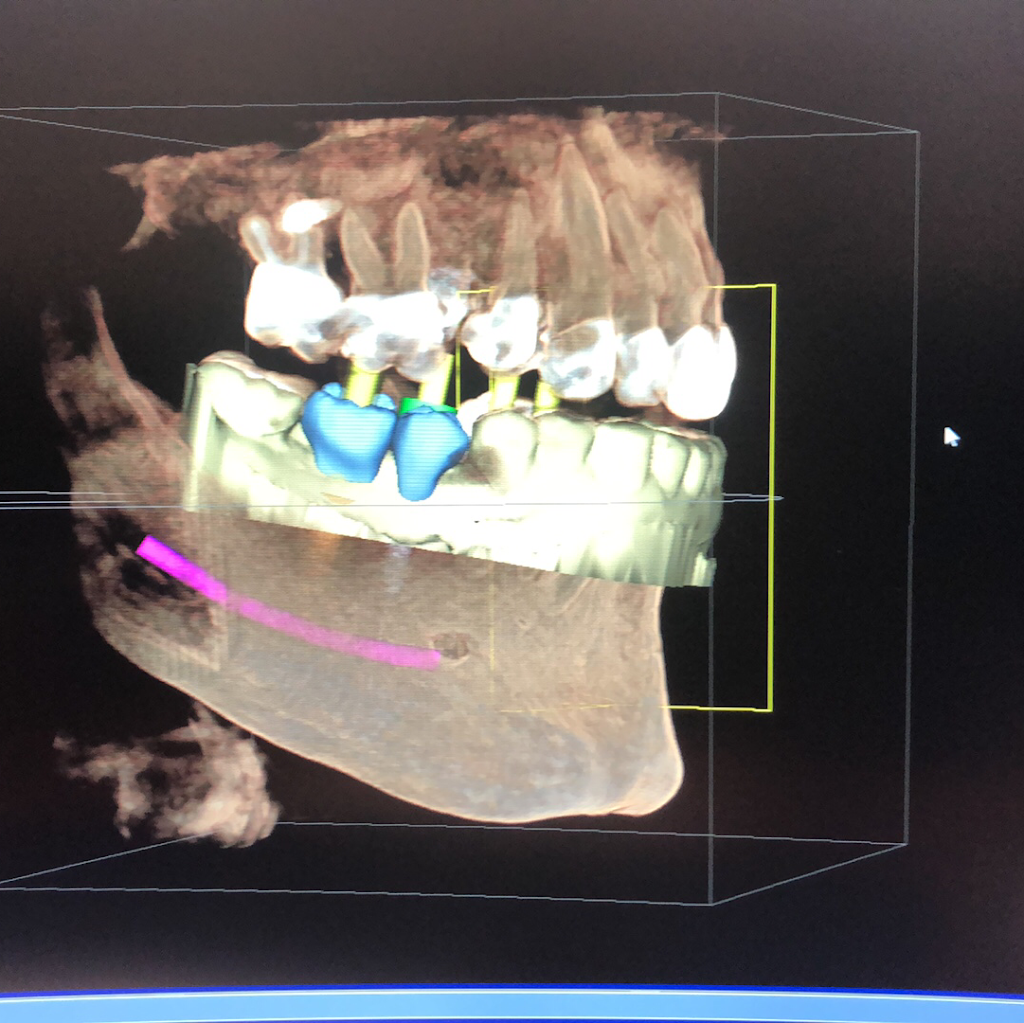 Queen Creek Complete Dental | 18471 E Queen Creek Rd #106, Queen Creek, AZ 85142, USA | Phone: (480) 722-1200