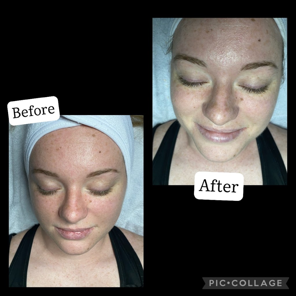 Bella Skin by Hailey | 6362 Cypress Gardens Blvd, Winter Haven, FL 33884, USA | Phone: (863) 624-2962