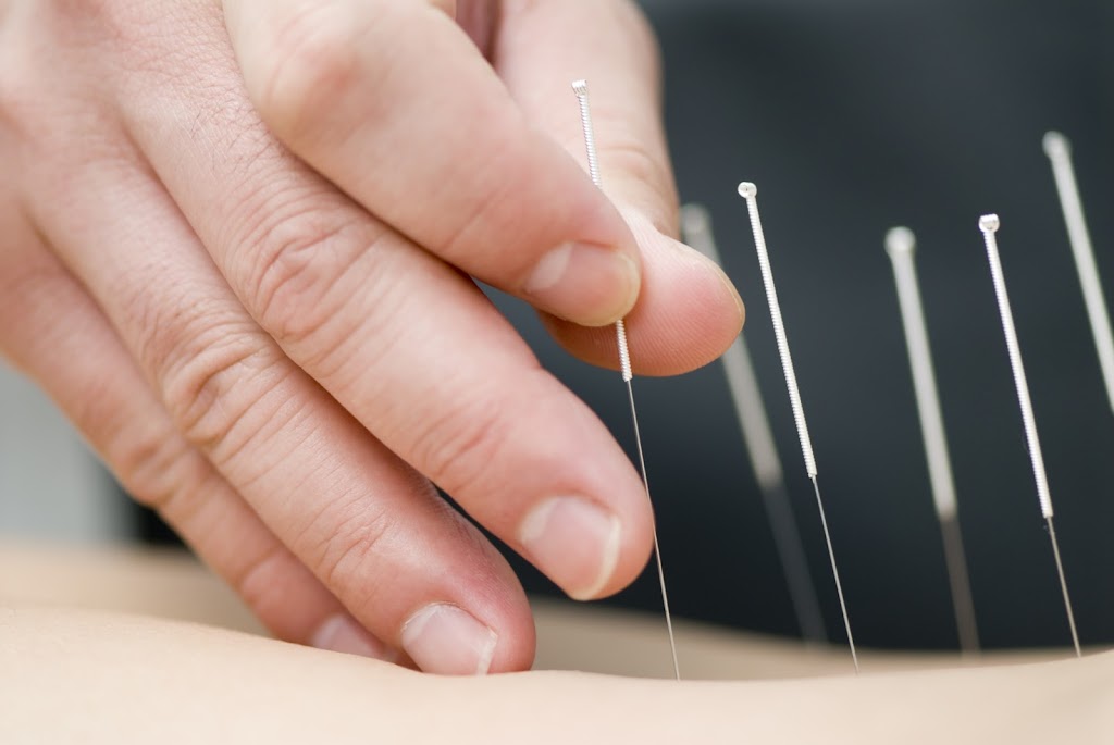 u Acupuncture Health Center | 1613 S Main St Suite 101, Milpitas, CA 95035, USA | Phone: (510) 733-0202