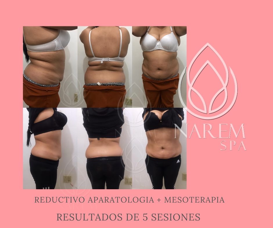 Narem Spa | Blvd. Fundadores 450, 21478 Tecate, B.C., Mexico | Phone: 665 150 8904