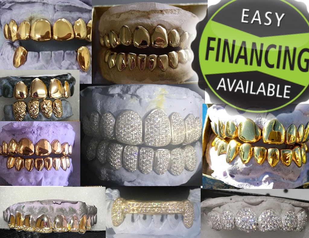 The Plug Custom Grillz | 3701 NW 9th Ave #3, Pompano Beach, FL 33064 | Phone: (561) 860-1364