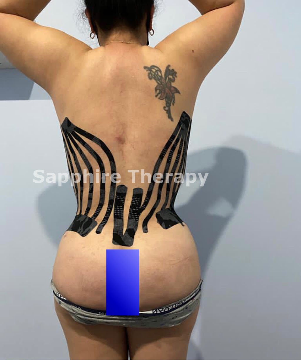 Sapphire Therapy Miami: Lymphatic Drainage Center | 5923 SW 8th St, Miami, FL 33144, USA | Phone: (305) 742-0840