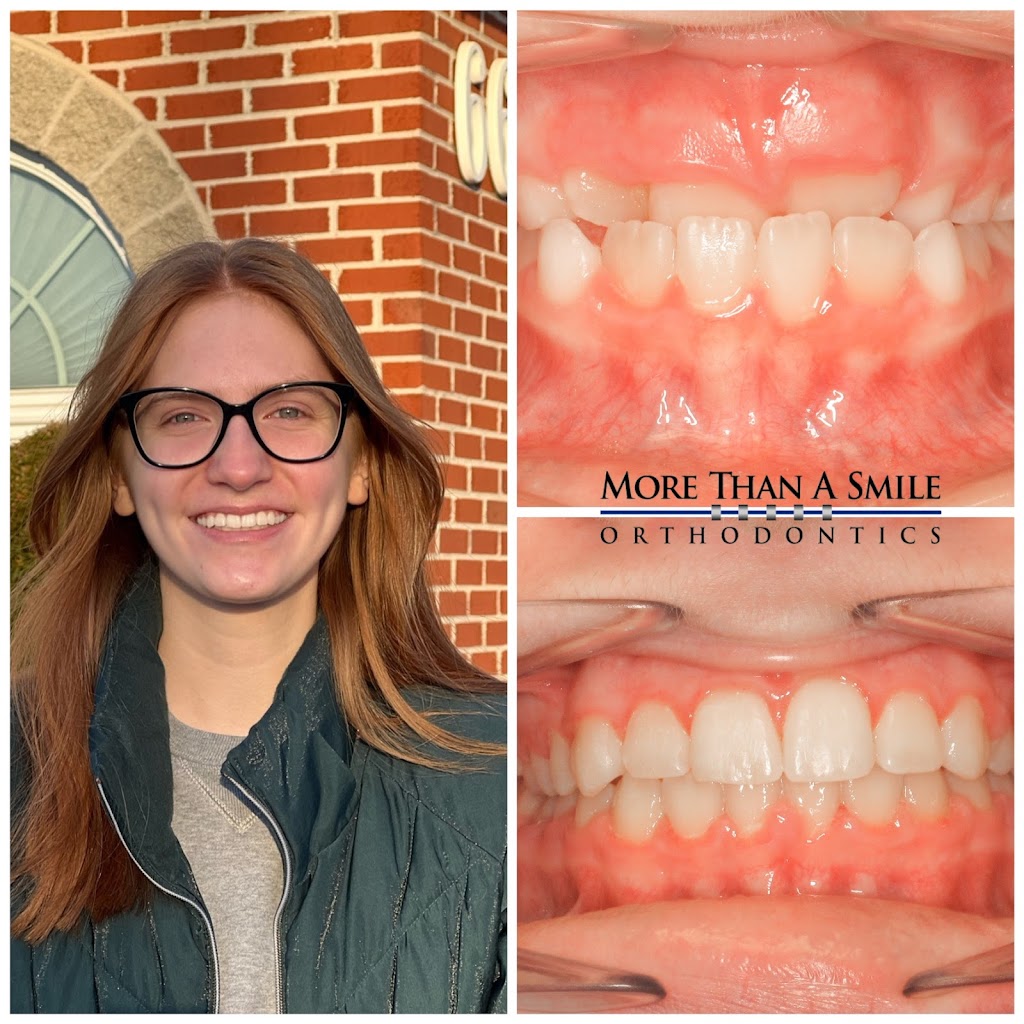 More Than A Smile Orthodontics | 2185 Bullis Rd, Elma, NY 14059, USA | Phone: (716) 652-0140