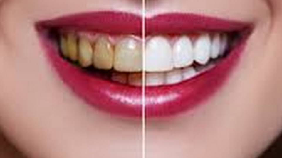 Family And Cosmetic Dentistry | 756 Madison Ave, Albany, NY 12208, USA | Phone: (518) 427-2808