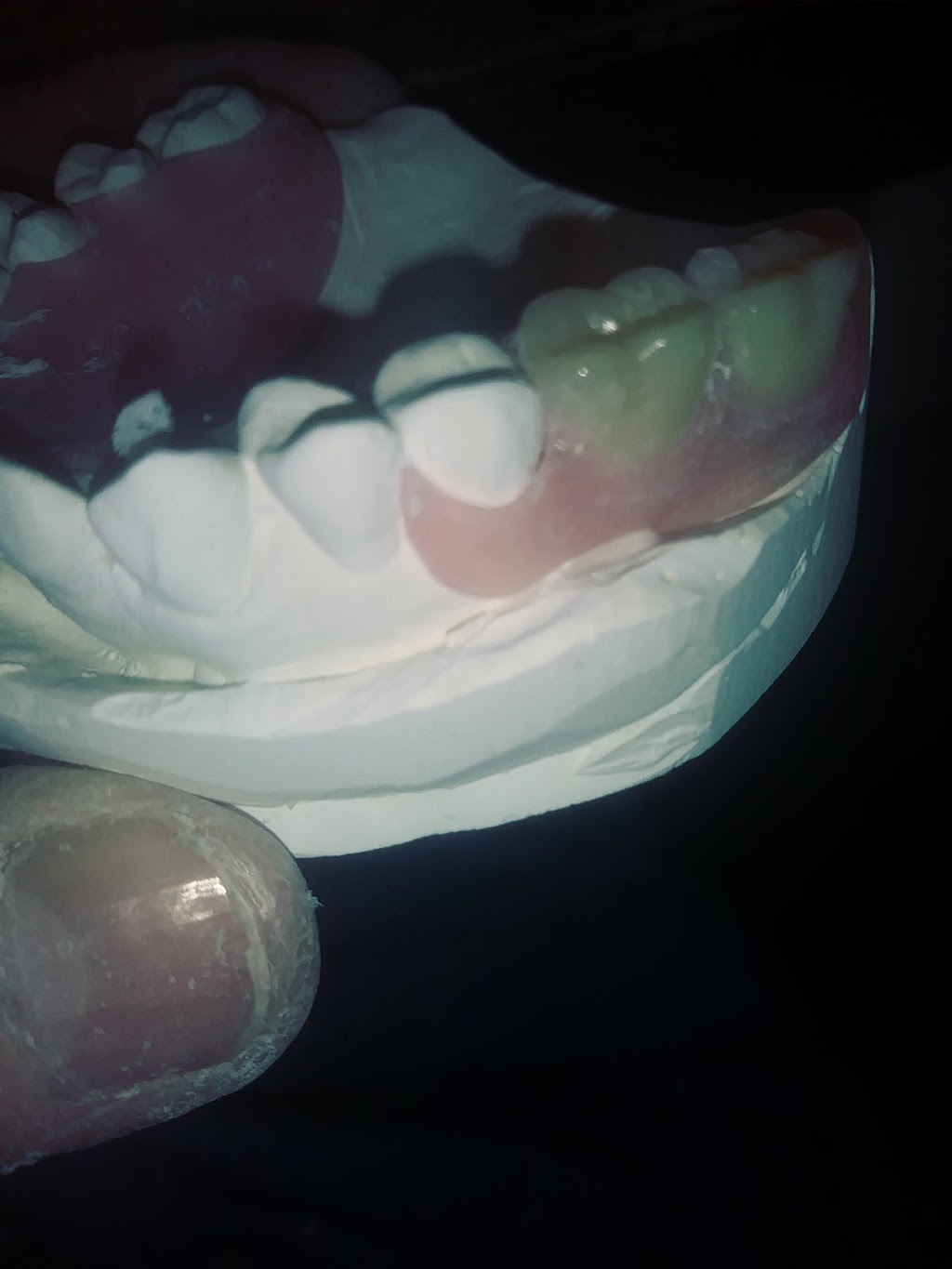 R&B Dental Lab | 21374 Ramona Ave, Apple Valley, CA 92307, USA | Phone: (760) 261-2425