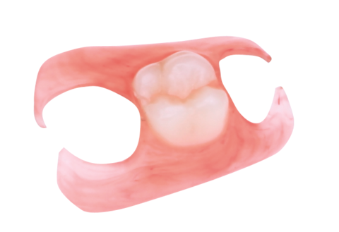 Custom Dentures Lab | 7160 W Glenn Dr, Glendale, AZ 85303, USA | Phone: (623) 845-2155