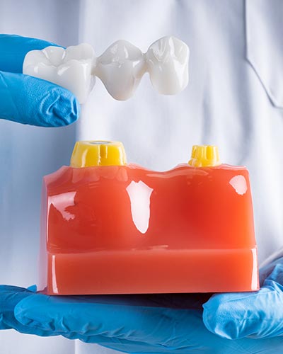 Selective Dental | 3151 S White Rd #203, San Jose, CA 95148, USA | Phone: (408) 763-5514