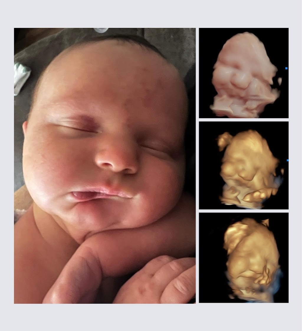 The Baby Studio 4D Ultrasound | 111 N 5th St, Chickasha, OK 73018 | Phone: (405) 759-4051