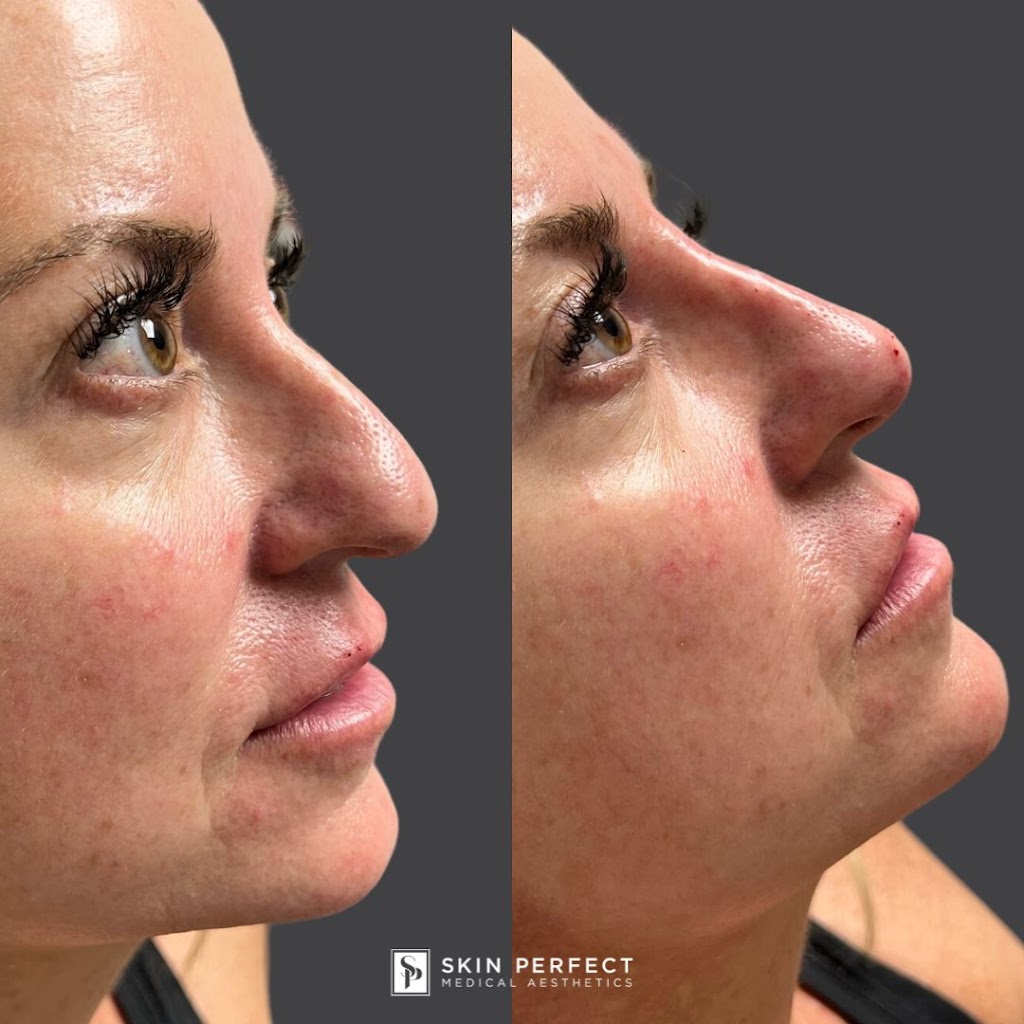 Skin Perfect Medical Aesthetics | 3030 Harbor Blvd f, Costa Mesa, CA 92626, USA | Phone: (714) 485-3212