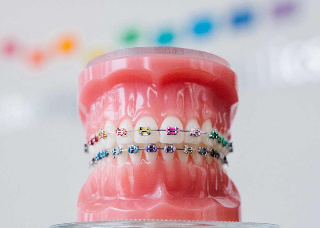 Schoettger Orthodontics | 8000 S 13th St, Lincoln, NE 68512, USA | Phone: (402) 423-8000