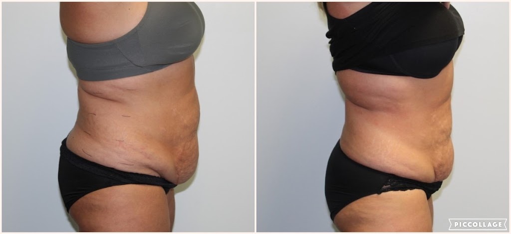 KY UltraSlim | 12400 Shelbyville Rd, Louisville, KY 40243, USA | Phone: (502) 501-9660