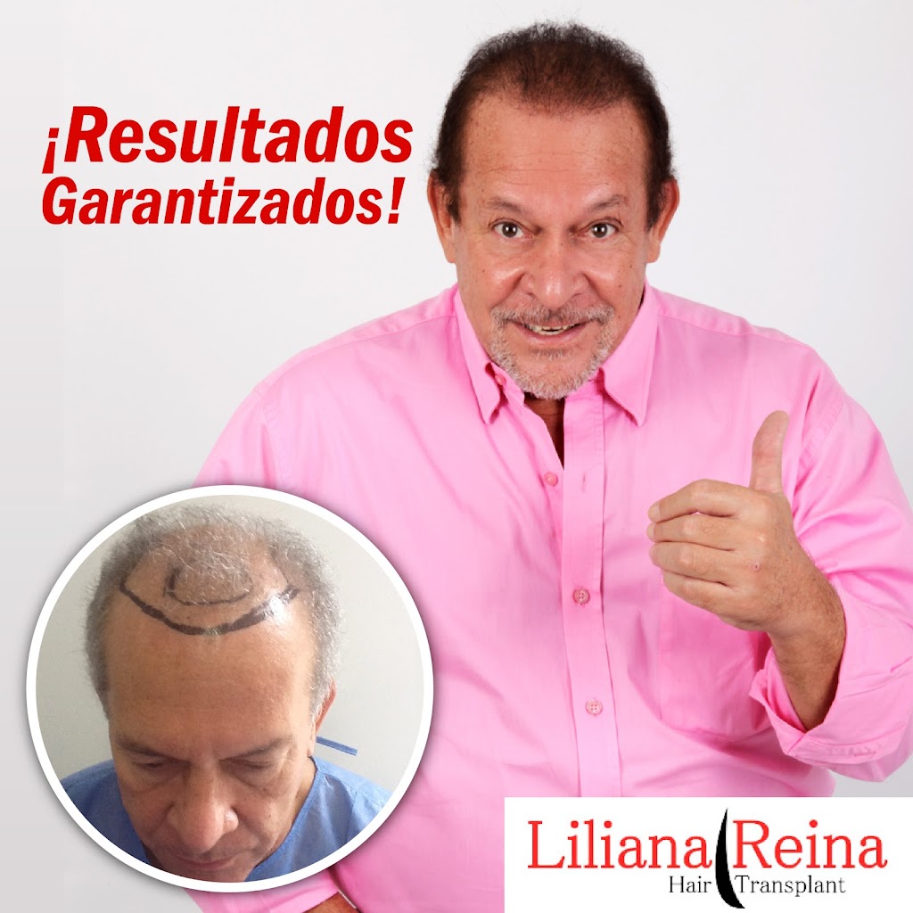 Reina Hair Transplant | 90 Indian Trace, Weston, FL 33326 | Phone: (561) 703-3253