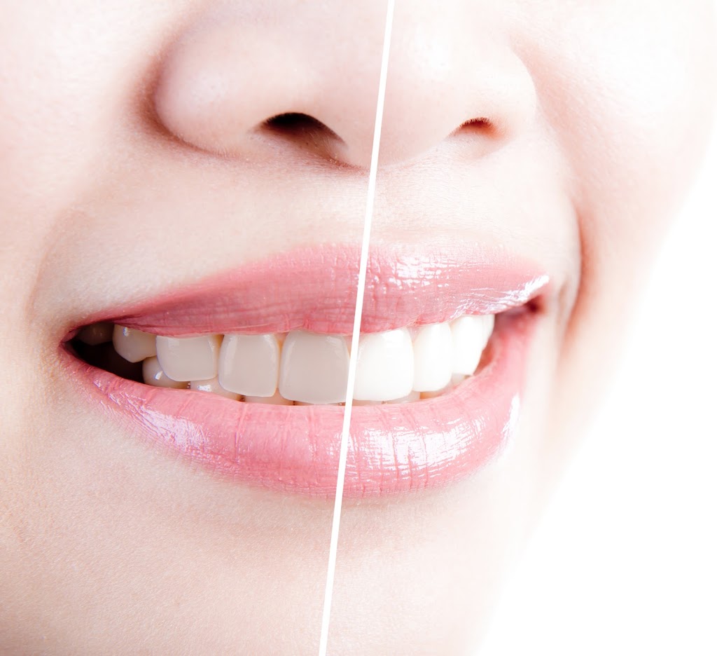 Fort Street Dentistry | 4009 Fort St, Lincoln Park, MI 48146, USA | Phone: (313) 928-8555