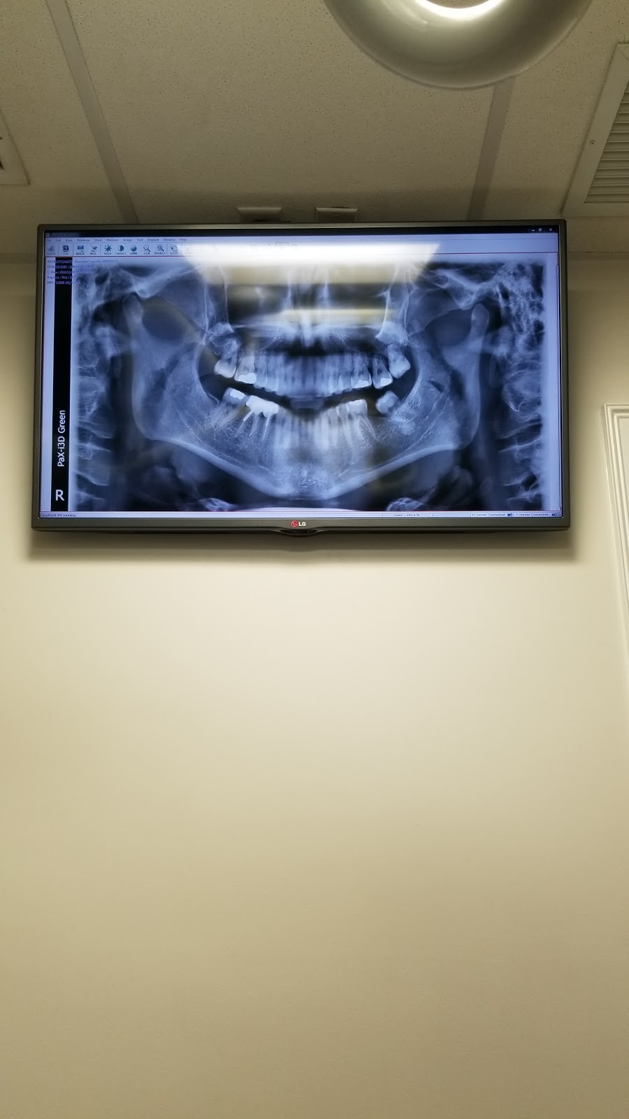 Plantation Oral Surgery and Dental Implants | 201 NW 70th Ave D, Plantation, FL 33317, USA | Phone: (954) 792-5544