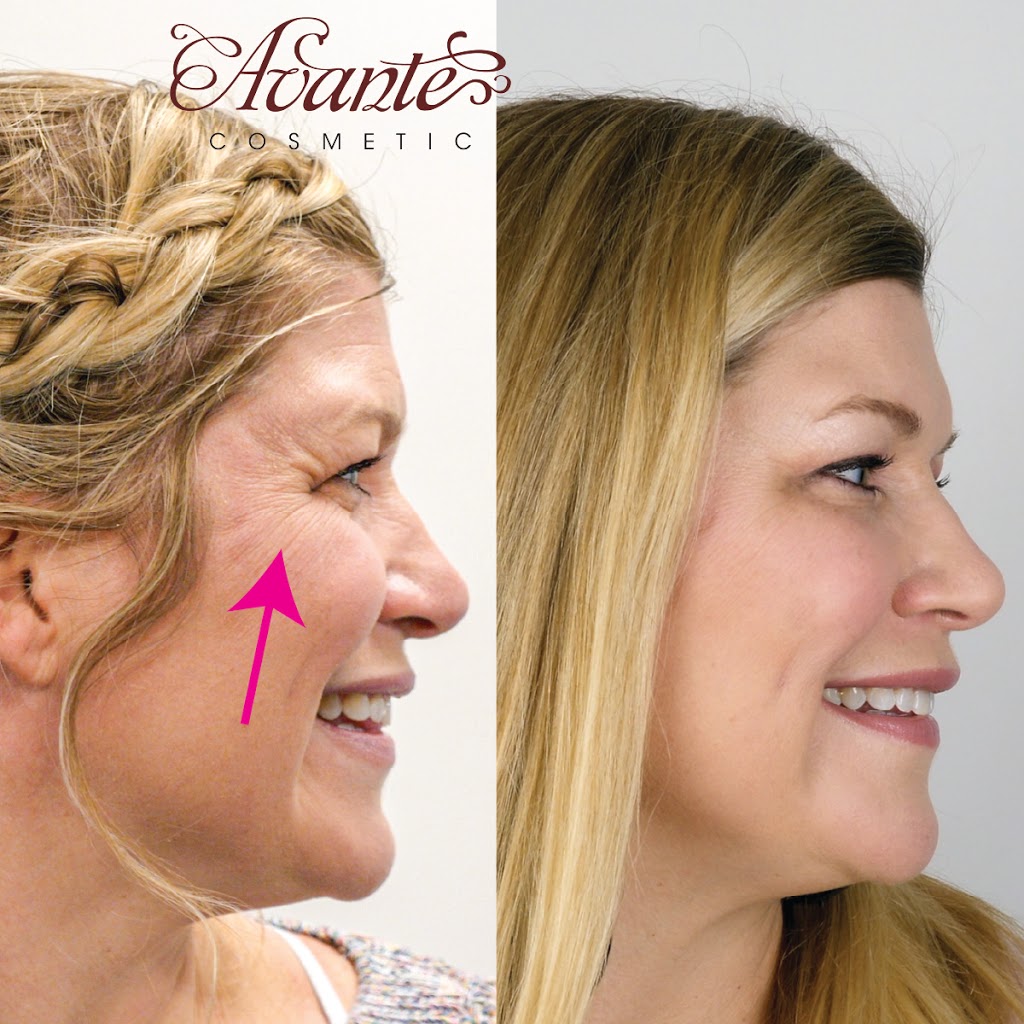 Avante Cosmetic | 9035 Wadsworth Pkwy #3650, Westminster, CO 80021, USA | Phone: (720) 352-4447
