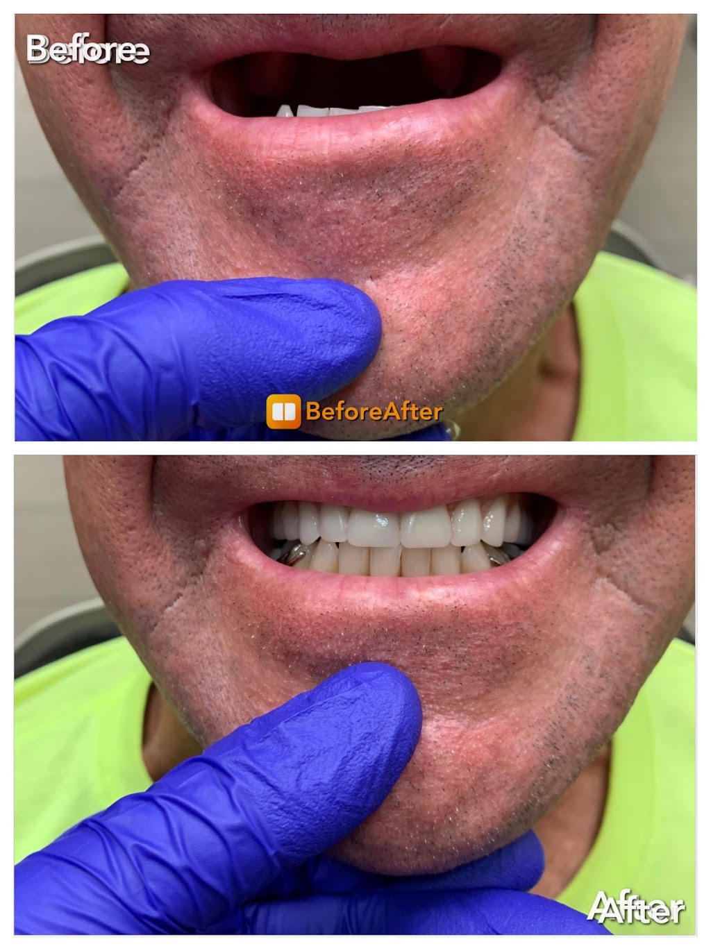 Direct Dental Lab (Denture Repair Service) | 9111 W Viking Rd, Las Vegas, NV 89147, USA | Phone: (818) 726-7468