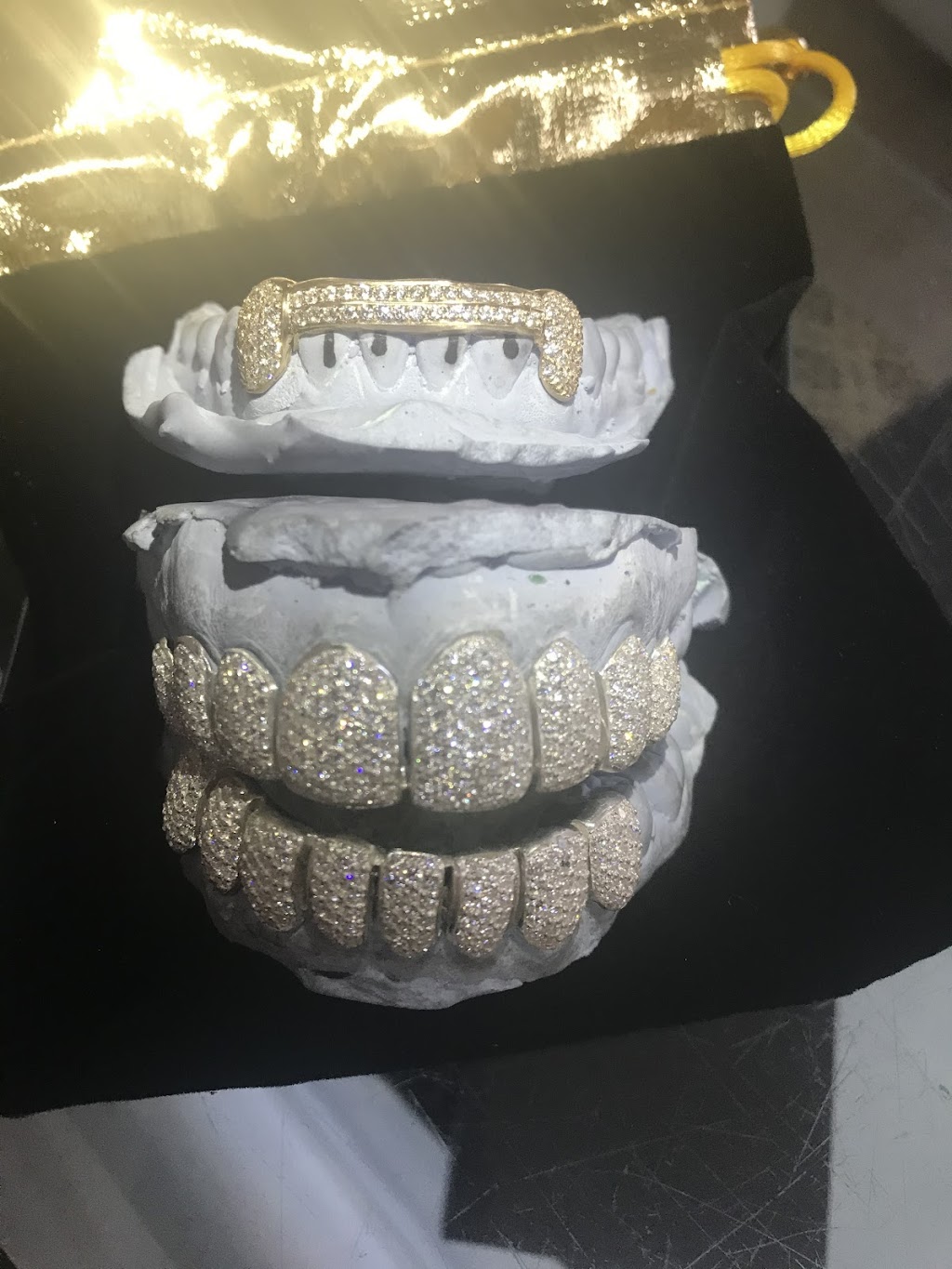 The Plug Custom Grillz | 3701 NW 9th Ave #3, Pompano Beach, FL 33064, USA | Phone: (561) 860-1364