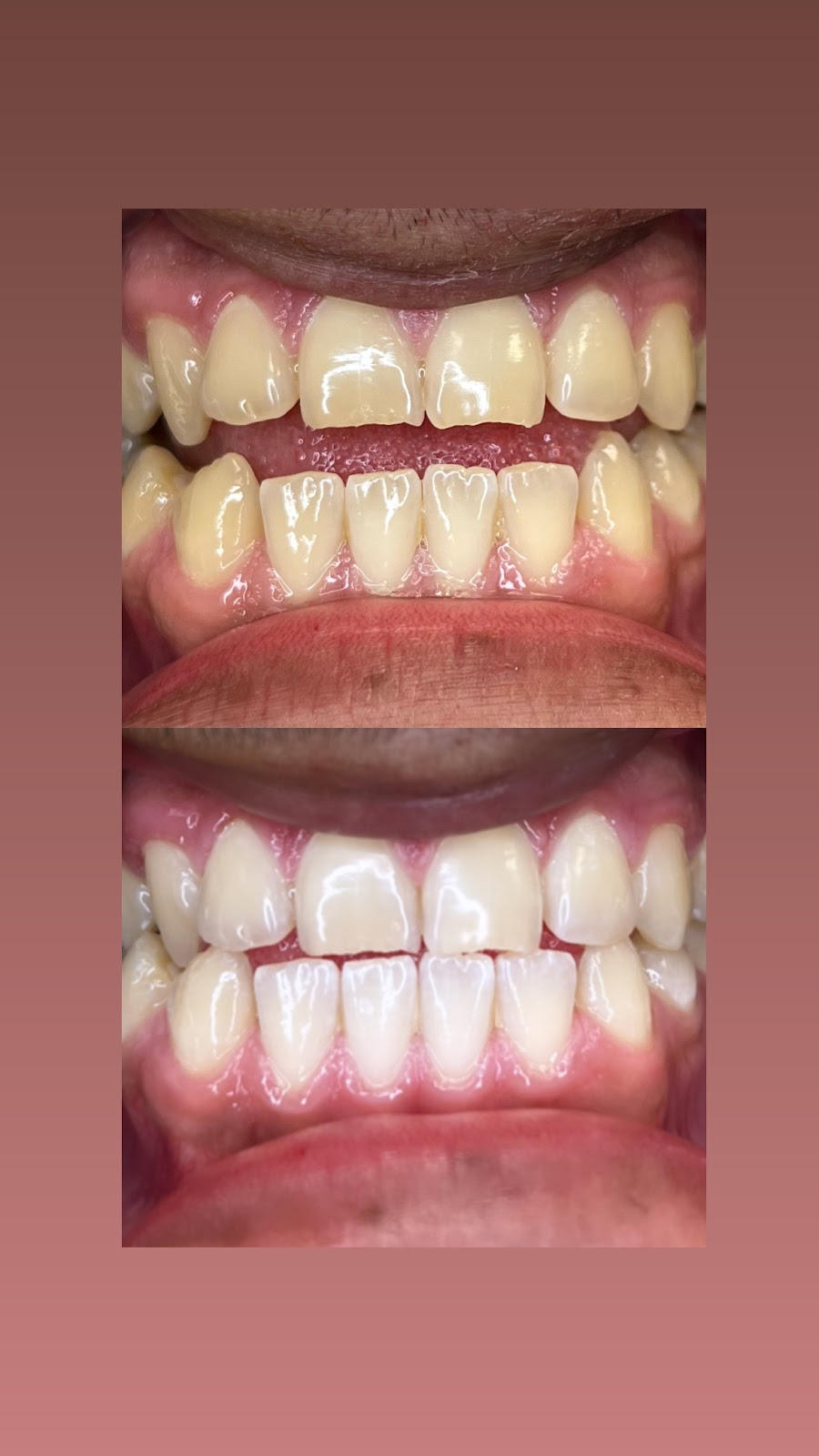 Million Dolla Smile | 1340 N Town E Blvd, Mesquite, TX 75150 | Phone: (214) 694-1256