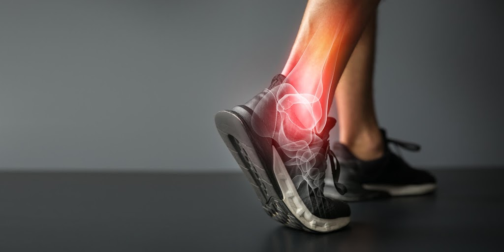 Revive Foot & Ankle Center | 22110 Roscoe Blvd # 201, West Hills, CA 91304, USA | Phone: (800) 698-5064