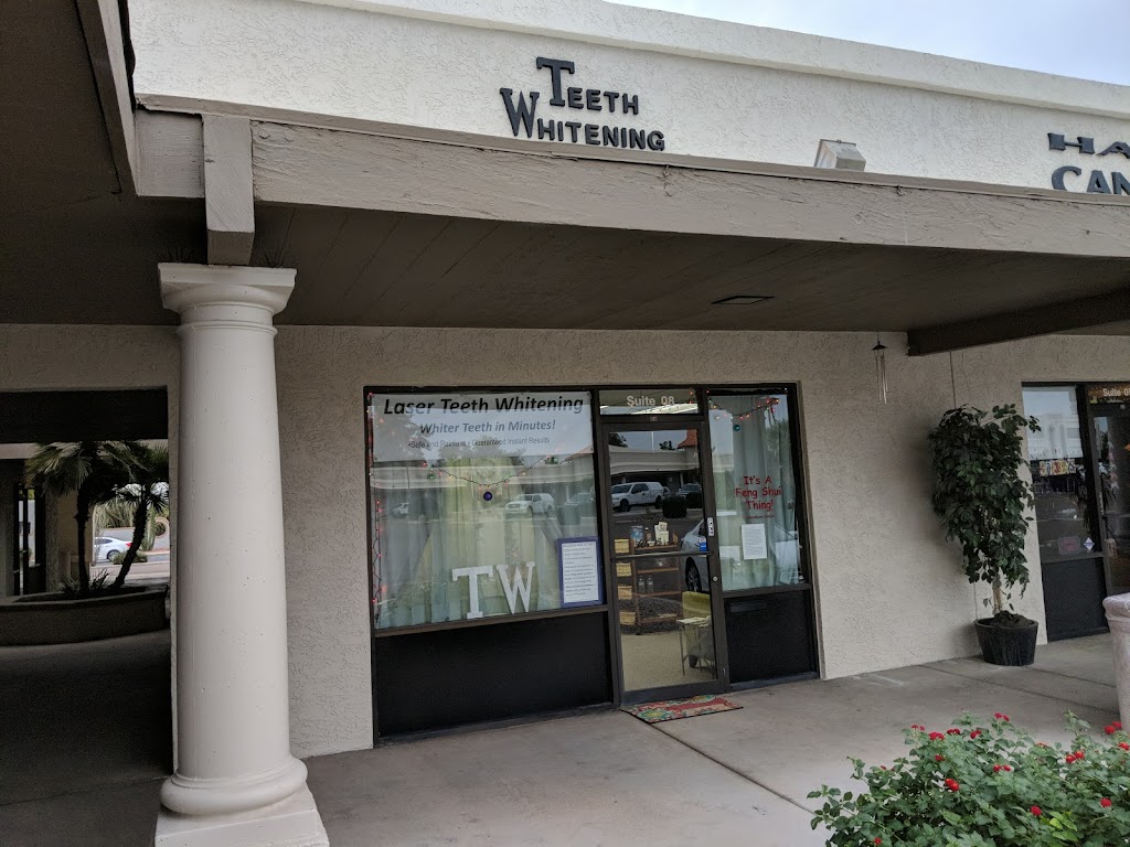 Teeth Whitening by Da Vinci | 2655 W Guadalupe Rd #8, Mesa, AZ 85202, USA | Phone: (480) 807-0002