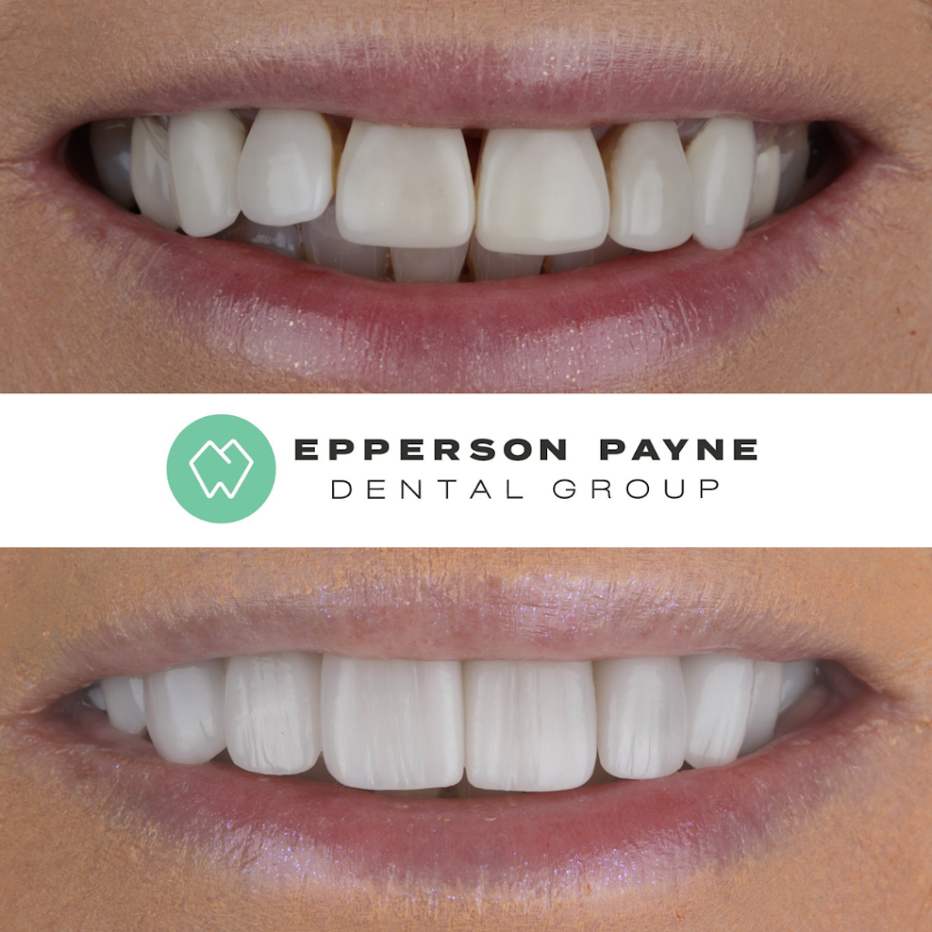 Epperson Payne Dental Group | 8220 Memphis Ave, Lubbock, TX 79423, USA | Phone: (806) 745-1745