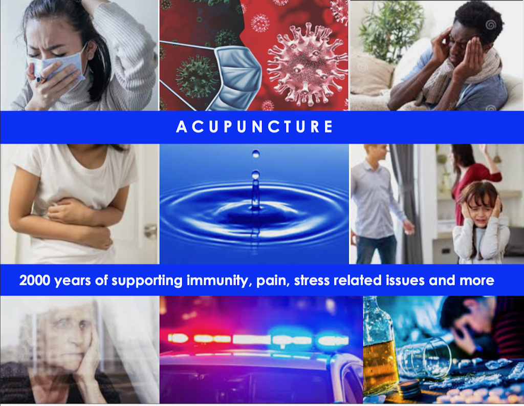 Fengli Lan, PhD., L.Ac. (Research-based Acupuncture) | 624 Frederick St, Santa Cruz, CA 95062, USA | Phone: (831) 346-8252