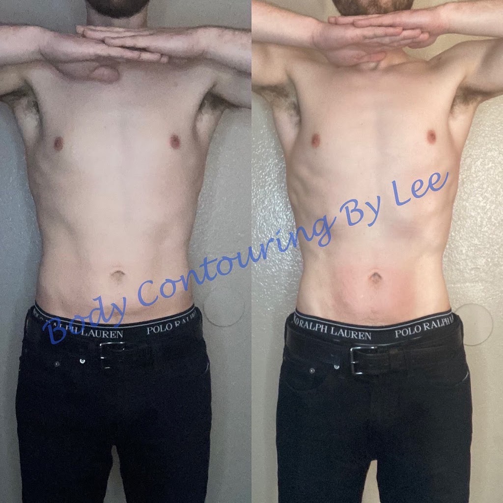 Body Contouring By Lee | Parking lot, 1547 E Broadway Rd, Mesa, AZ 85204 | Phone: (602) 693-4341