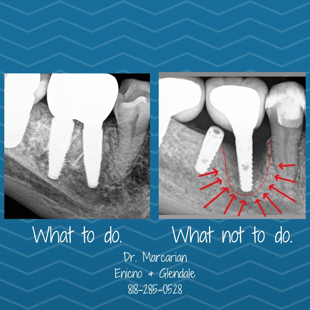 Gevik Marcarian DDS | 16661 Ventura Blvd #611, Encino, CA 91436, USA | Phone: (818) 285-0528