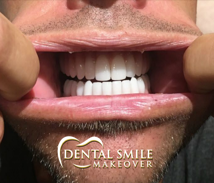 Dental Smile Makeover | 2090 Godby Rd, College Park, GA 30349, USA | Phone: (770) 991-0212