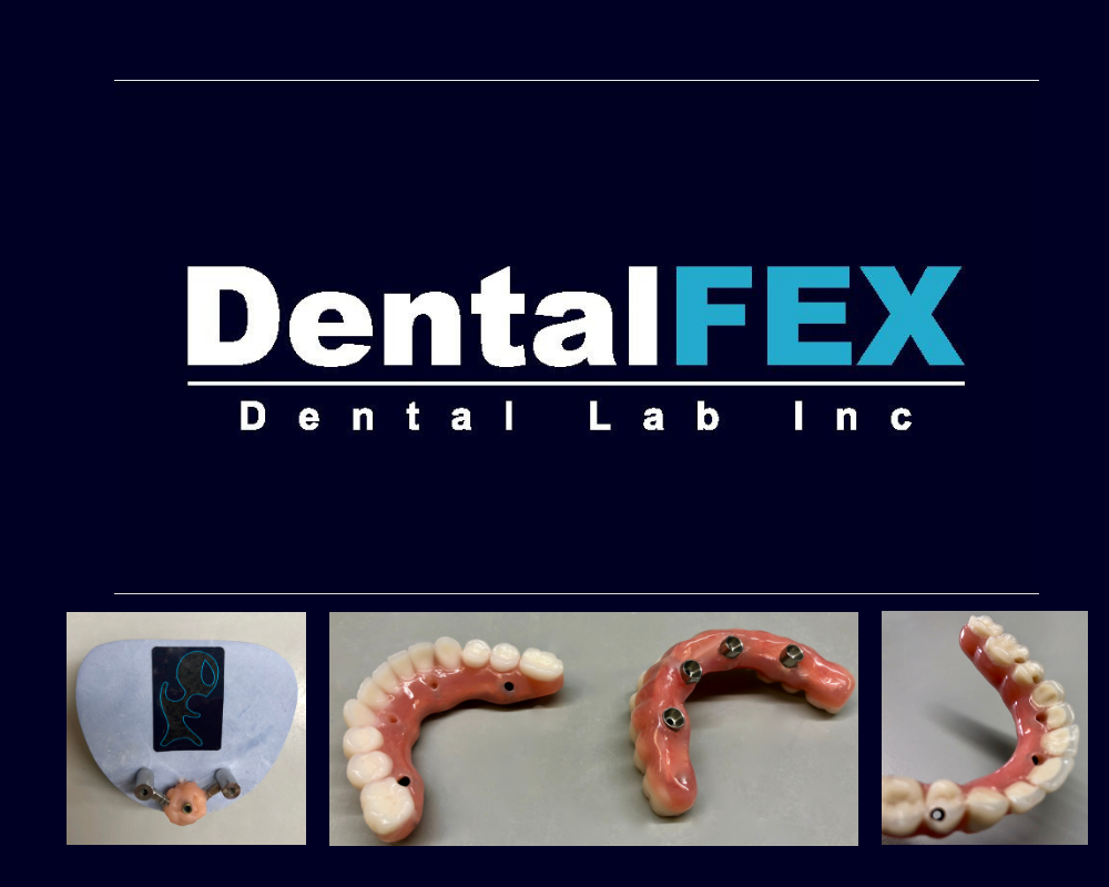 DentalFex Dental Lab | 665 Frontage Rd, Longmont, CO 80501, USA | Phone: (303) 651-2906