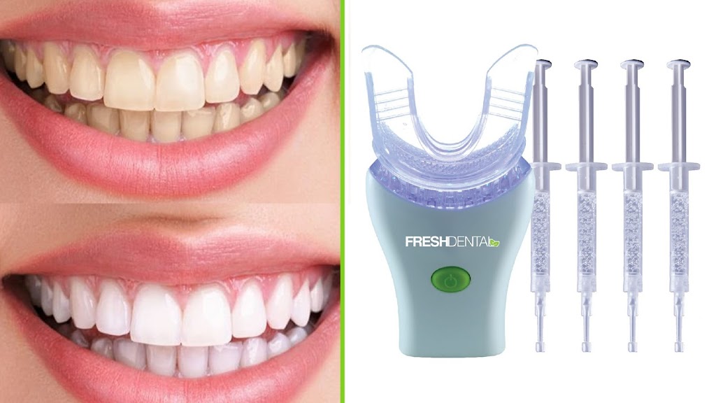 Fresh Dental Gastonia NC | 4008 E Franklin Blvd #100, Gastonia, NC 28056, USA | Phone: (704) 816-0649