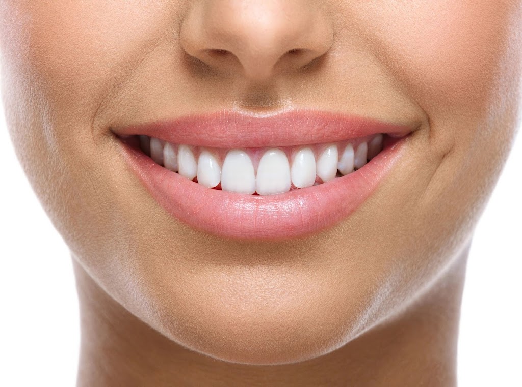 White Smiles Of Denton | 303 N Carroll Blvd, Denton, TX 76201, USA | Phone: (940) 594-3789